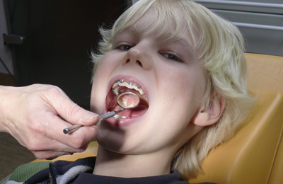 Kinderzahnheilkunde